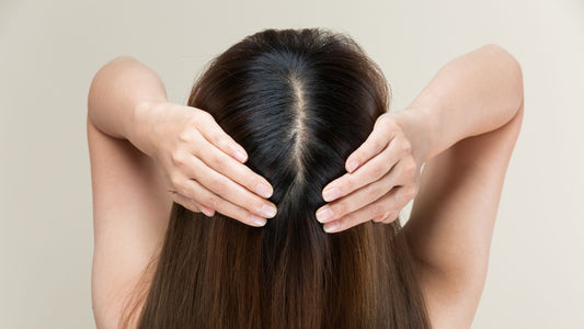 Millies Expert Tips for Oily Scalp Care
