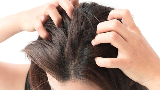 Millies Top Tips for Treating a Dry Scalp