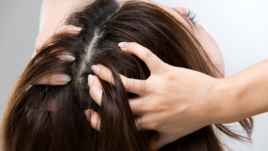 Scalp Concerns and How to Treat Them
