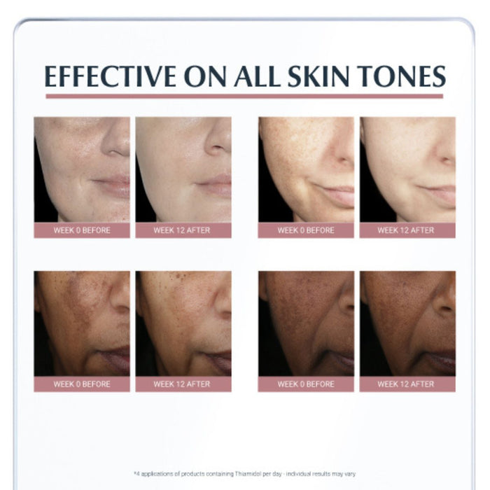 Eucerin Anti-Pigment Day SPF30 Cream