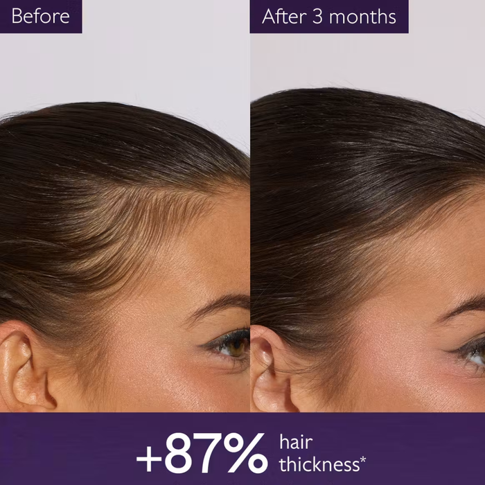 Caudalie Anti-Hair Loss Serum 50ml