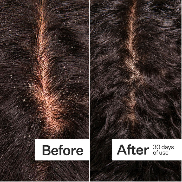 Act+Acre Microbiome Cooling Scalp Serum