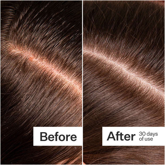 Act+Acre Microbiome Cooling Scalp Serum