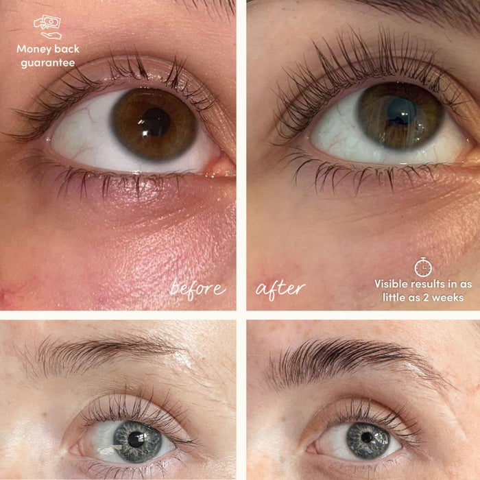 Glow For It Growth Starter Kit