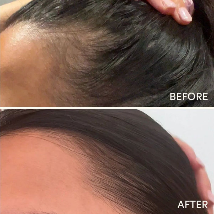 Glow For It Hair Growth Serum