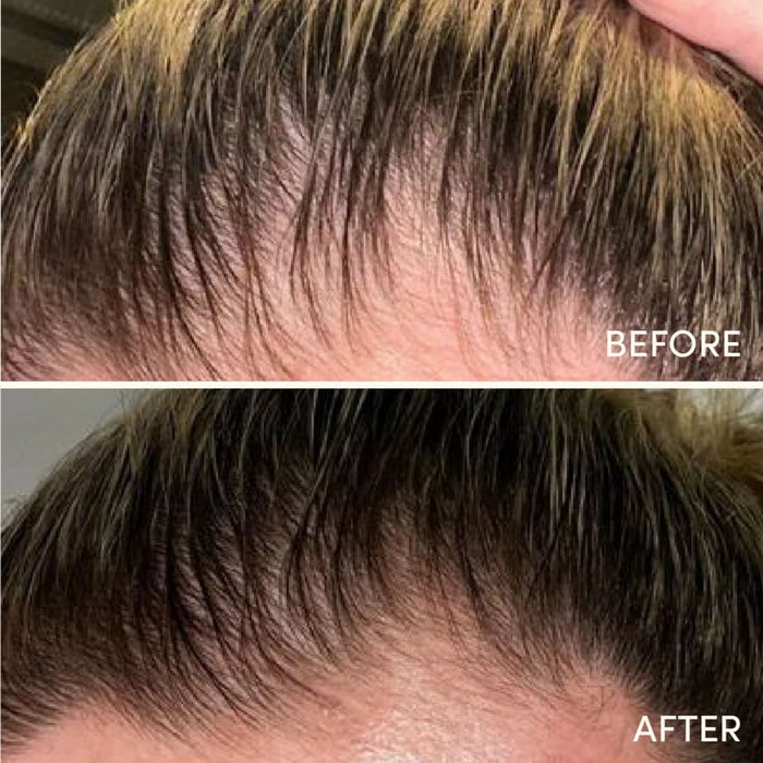 Glow For It Hair Growth Serum