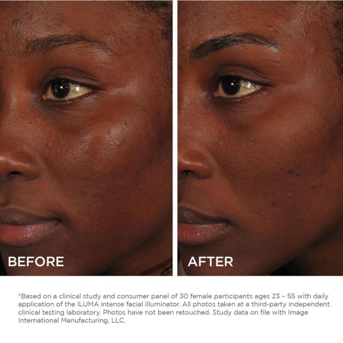 IMAGE Skincare Iluma Intense Facial Illuminator