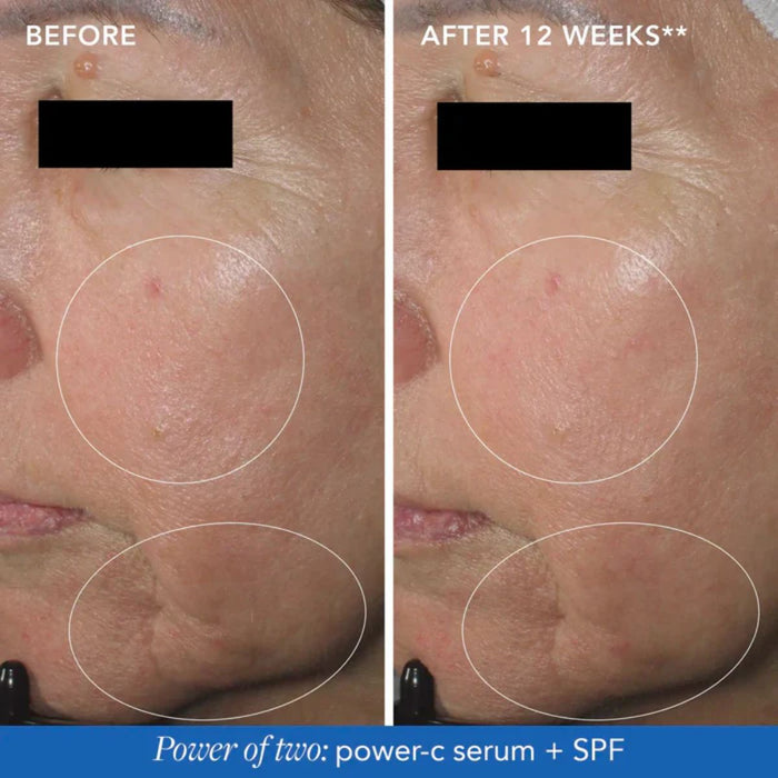 IMAGE Skincare MD Restoring Power-C Serum