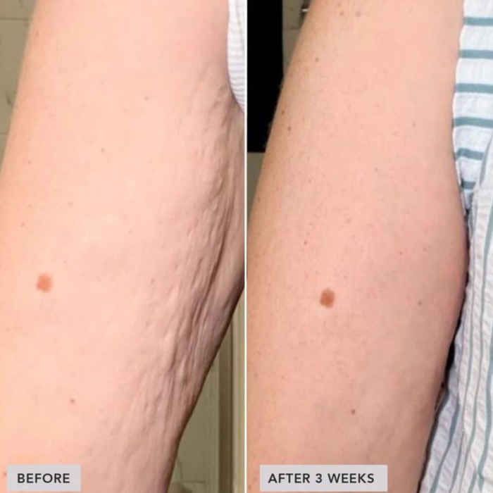 IMAGE Skincare VOL.U.LIFT™ BODY Sculpt & Firm Body Complex 156g