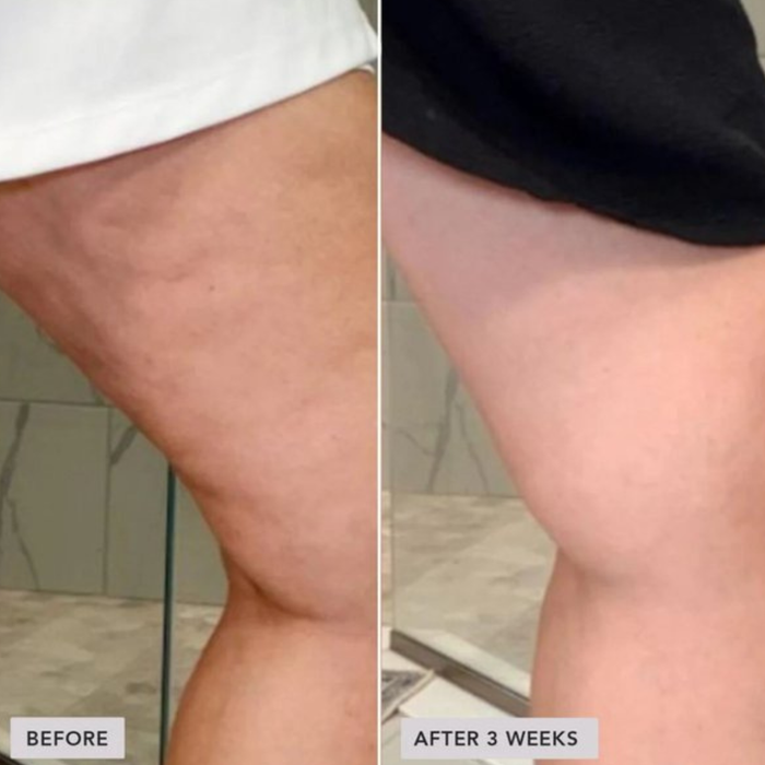 IMAGE Skincare VOL.U.LIFT™ BODY Sculpt & Firm Body Complex 156g