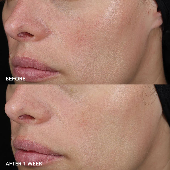 IMAGE Skincare MD Barrier Repair Recovery Balm