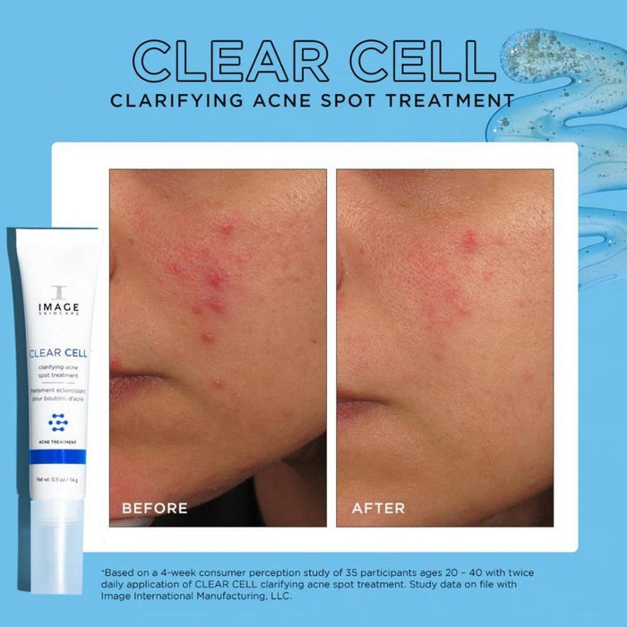 IMAGE Skincare Clear Cell Clarifying Salicylic Blemish Gel