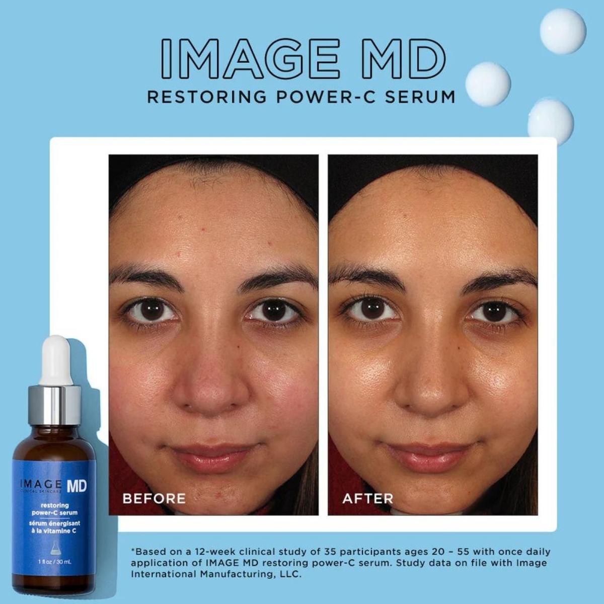 IMAGE Skincare MD Restoring Power C Serum 30ml