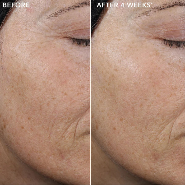 IMAGE Skincare Ageless+ Pure Liquid Retinol 0.3% Travel Size