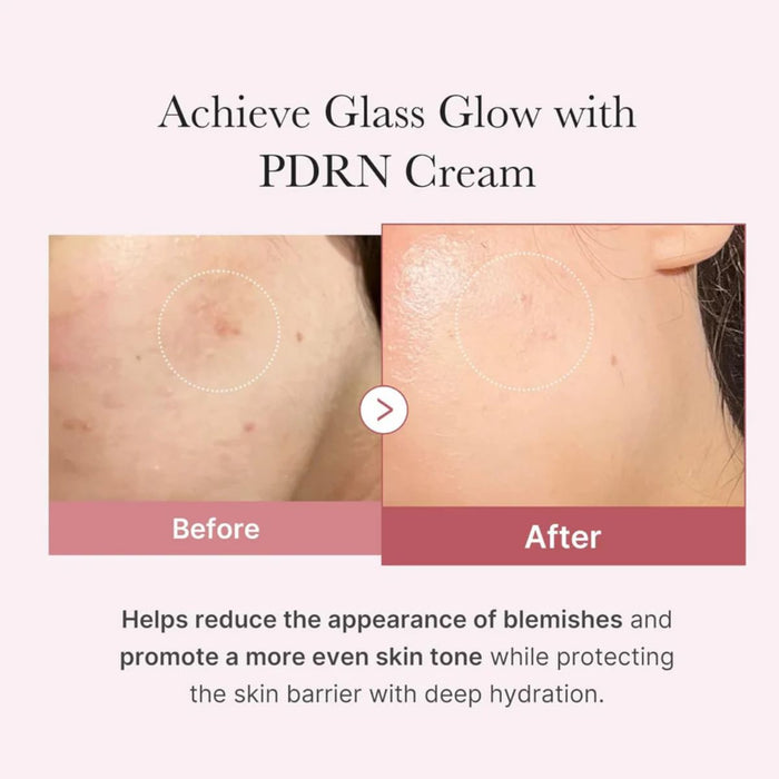 Medicube PDRN Pink Hyaluronic Moisturizing Cream 50ml