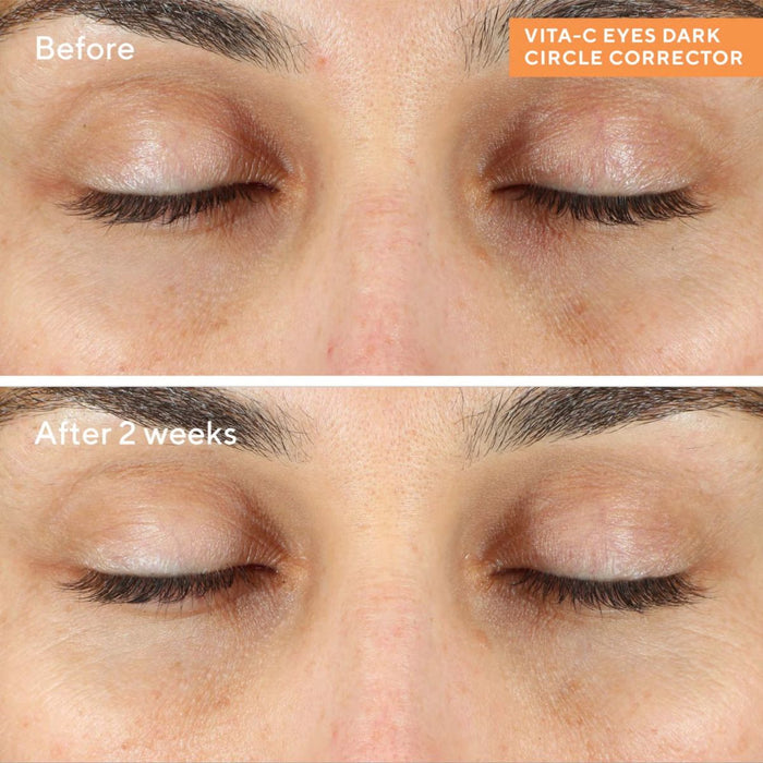 Murad Environmental Shield Vita-C Eyes Dark Circle Corrector