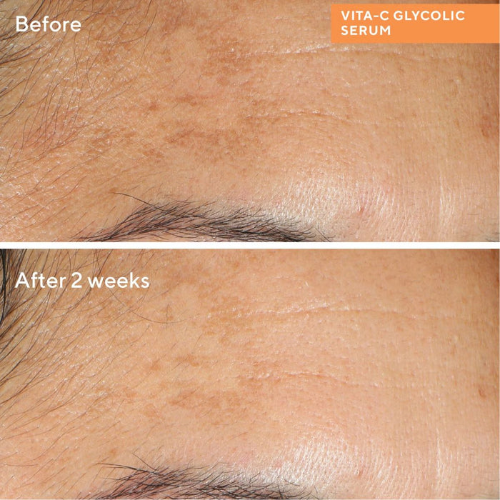 Murad Environmental Shield Vita-C Glycolic Brightening Serum