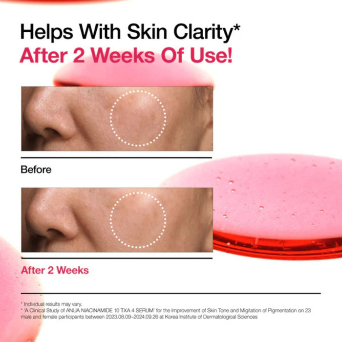 Niacinamide 10 TXA 4 Serum for Brightening and Dark Spots