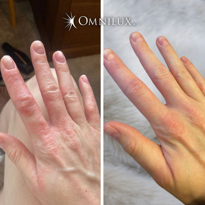 OMNILUX Contour LED Glove