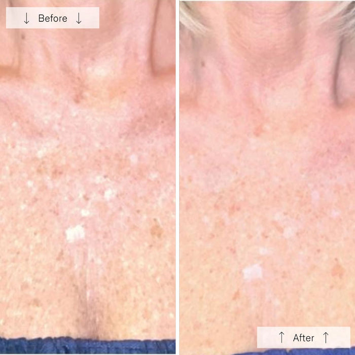 OMNILUX Contour LED Neck & Décolleté