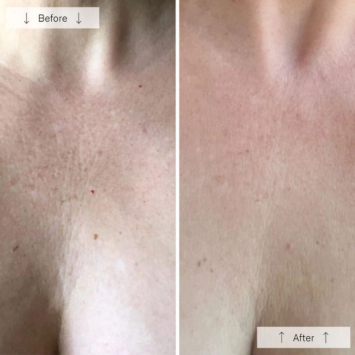 OMNILUX Contour LED Neck & Décolleté