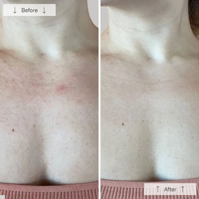 OMNILUX Contour LED Neck & Décolleté