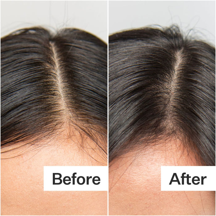 Act+Acre Oily Hair System