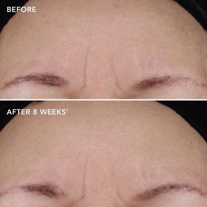 IMAGE Skincare Ageless+ Retinol Repair Crème  0.1% Retinol Complex Travel Size