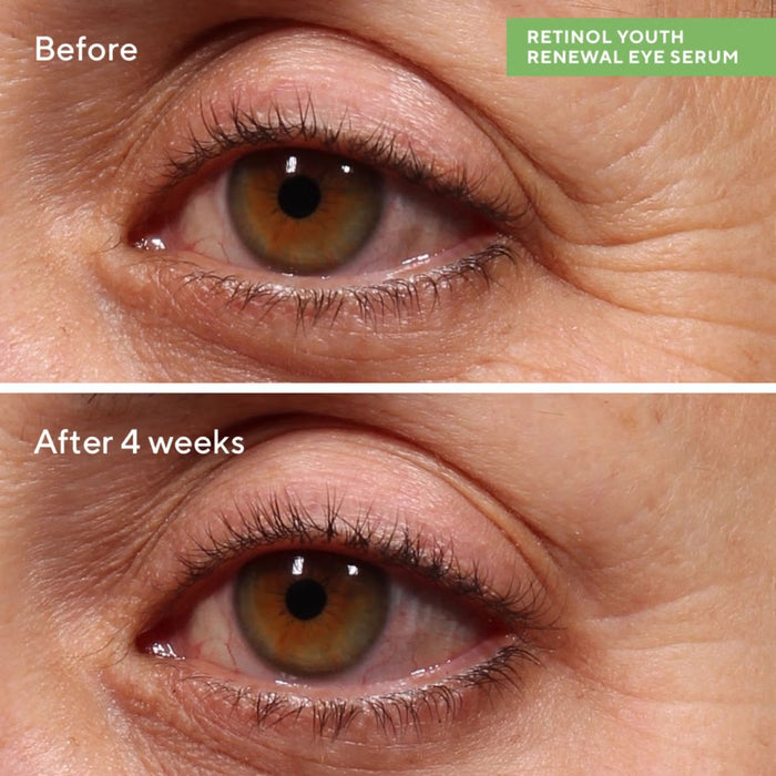 Murad Resurgence Retinol Youth Renewal Eye Serum