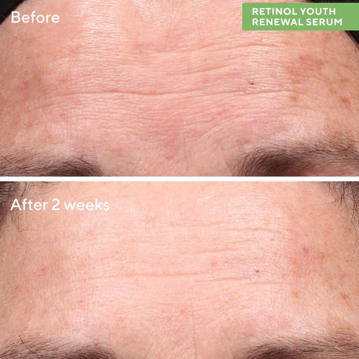 Murad Resurgence Retinol Youth Renewal Serum