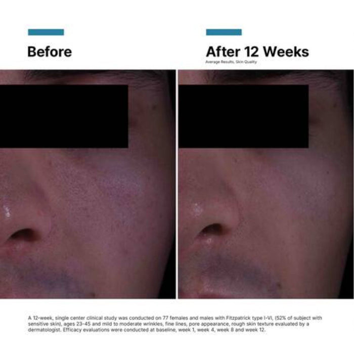 SkinCeuticals P-Tiox Cream 48ml