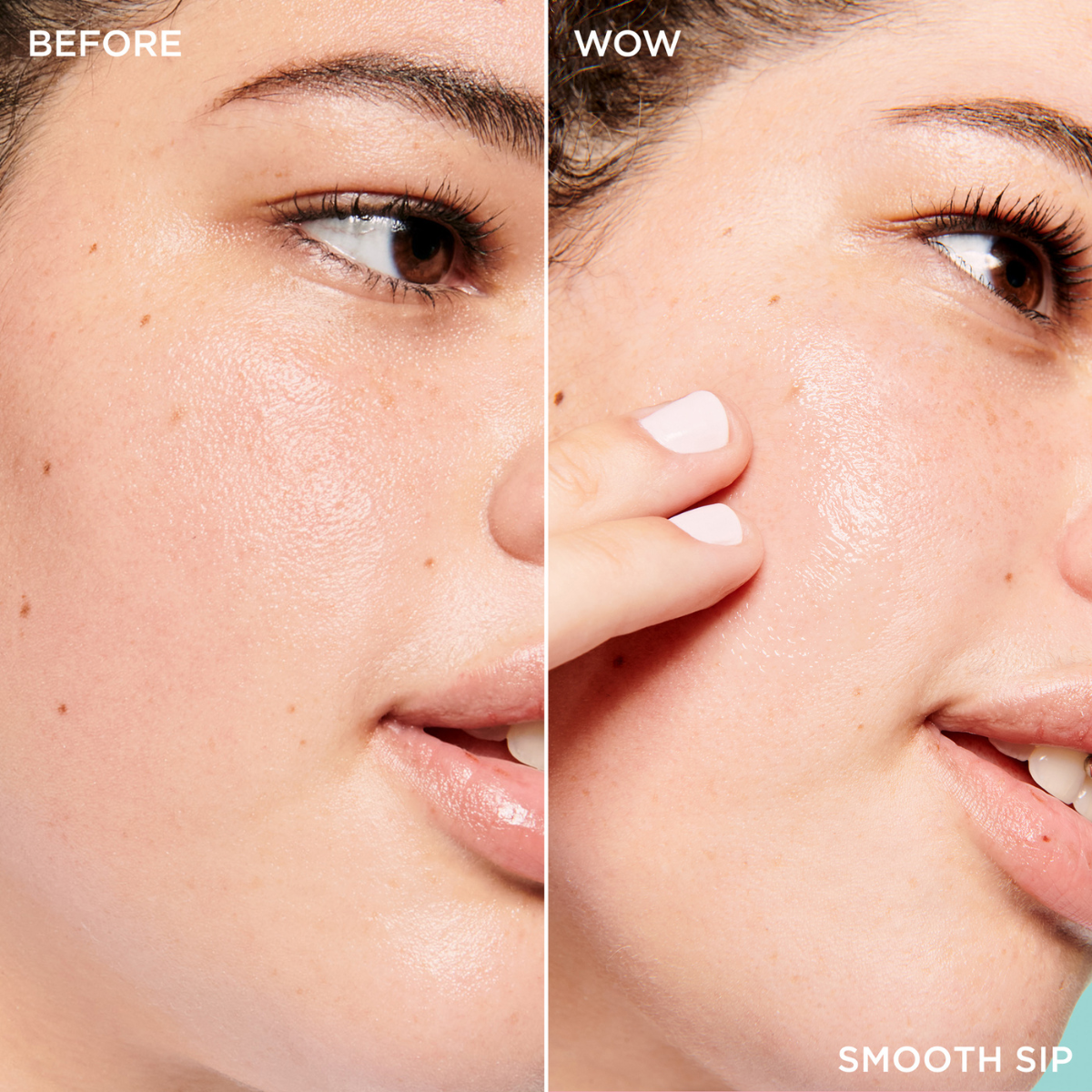 Before and after using Pore Routine Roundup Pore Care Set