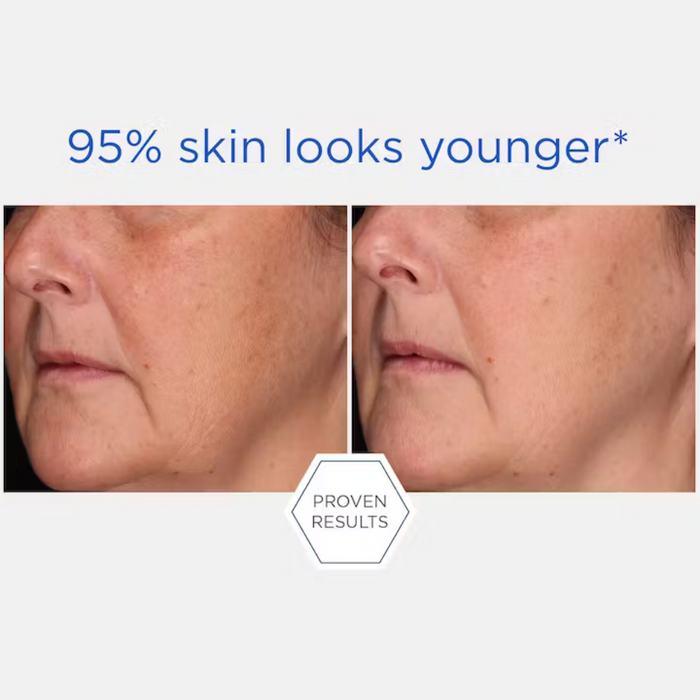 Neostrata Rebound Sculpting Cream 50g before and after 