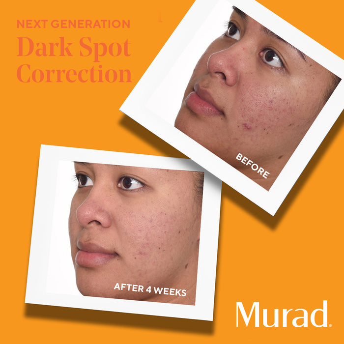 Murad Environmental Shield Rapid Dark Spot Correcting Serum
