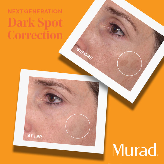 Murad Environmental Shield Rapid Dark Spot Correcting Serum