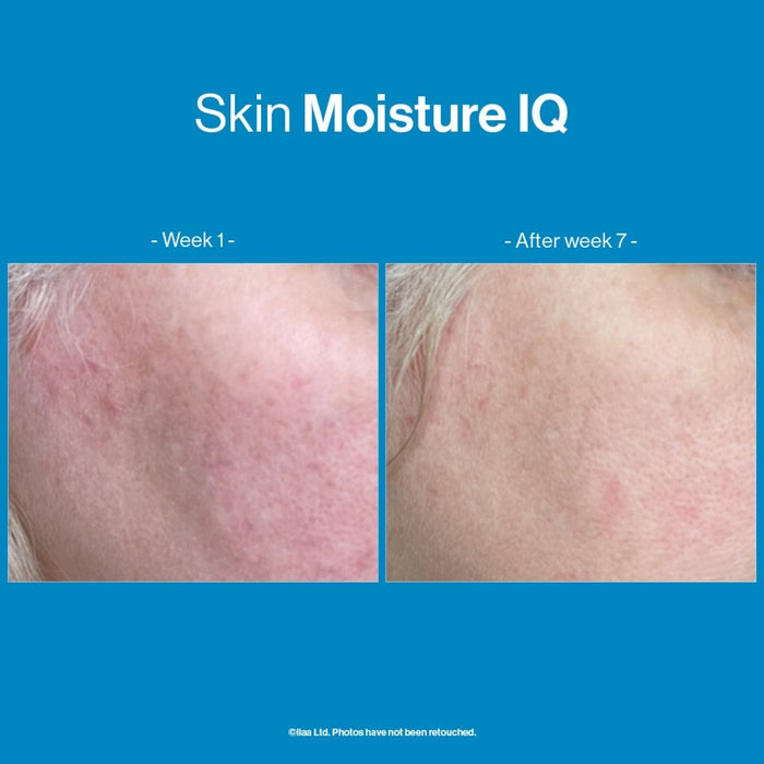 Advanced Nutrition Programme Skin Moisture IQ