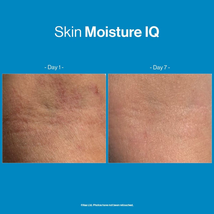 Advanced Nutrition Programme Skin Moisture IQ